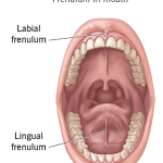 Tongue and Lip-Tie in Sylvan Lake